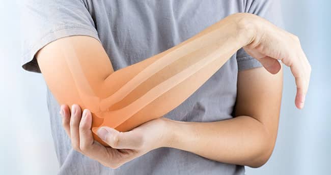 Arm & Leg Pain Treatment Prescott  Pain Management Clinic Prescott, AZ